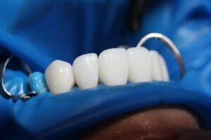 cosmetic dentistry