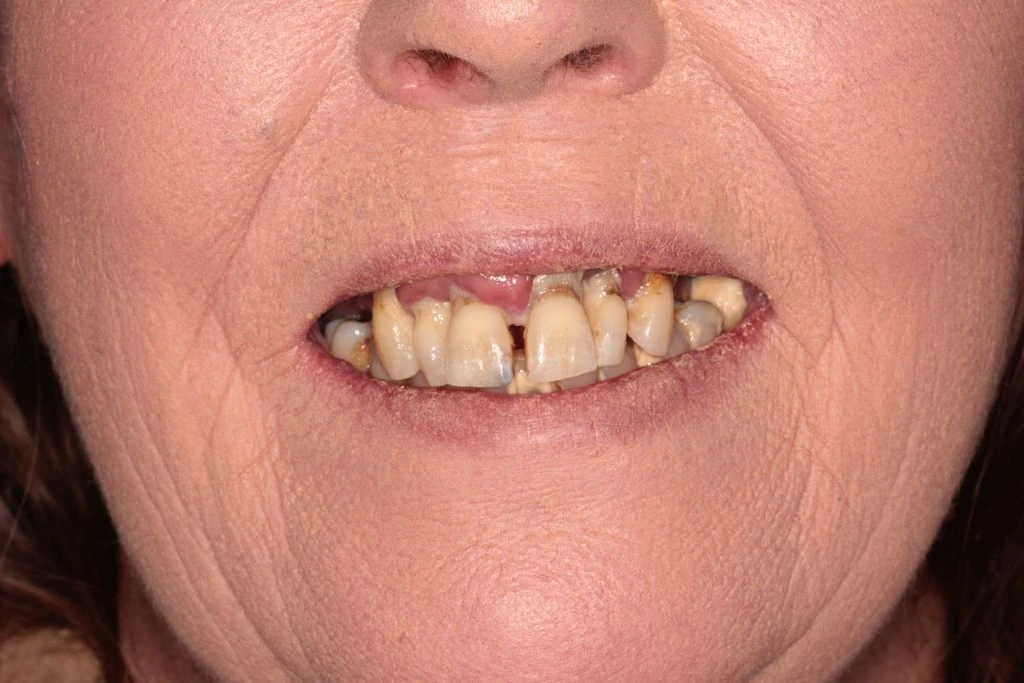 Catherine Edgeley – BEFORE Catherine Edgeley - BEFORE
